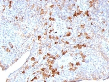IGLV1-51 Antibody