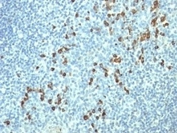 IGLV1-51 Antibody