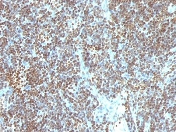 Double Stranded DNA Antibody [SPM603]