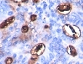 CA19-9 Antibody [SPM588]