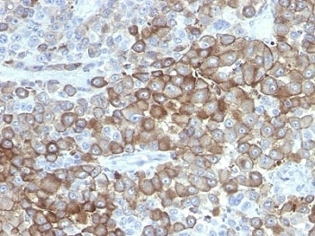 Melanoma Antibody [PNL2]
