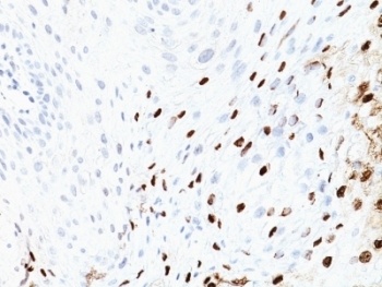 HPV-16 Antibody [SPM405]