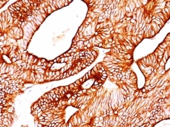 Cytokeratin 5/8 Antibody [SPM268]