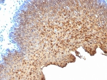 Cytokeratin 10 + 13 Antibody [SPM262]