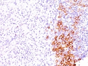 TNFRSF8 Antibody
