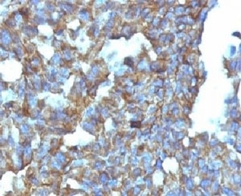CD99 Antibody