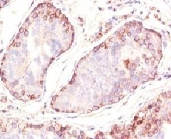 MAGEA1 Antibody