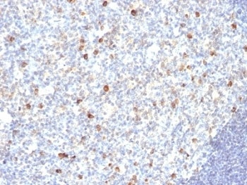 IgM Antibody [SPM188]