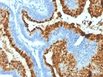 Blood Group Antigen B Antibody [HEB-20]