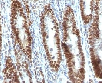 TOX3 Antibody