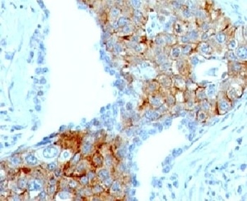 TRIM29 Antibody