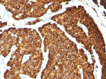 Chromogranin A Antibody [CHGA/777]