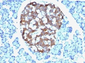 Chromogranin A Antibody [CHGA/765]