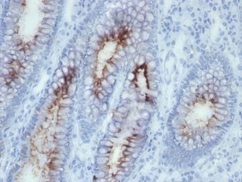 CEACAM5 Antibody