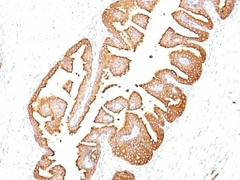 PSA Antibody [KLK3/801]