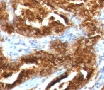 TAG-72 Antibody [CA72/733]