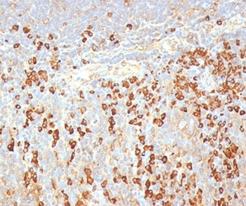 Plasma Cell Marker Antibody [LIV3G11]