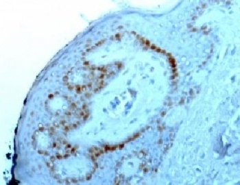 Nucleoli Marker Antibody [NM95]