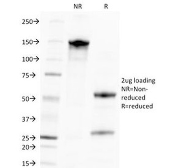 Cytomegalovirus Antibody [CMV100]