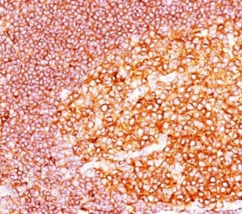 MALT1 Antibody