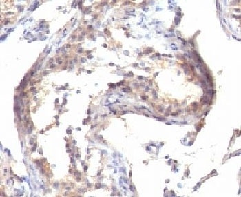 TGFA Antibody