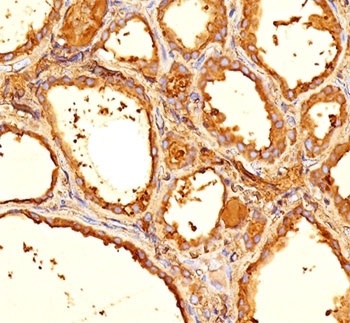 Thyroglobulin Antibody [6E1 or TGB05]