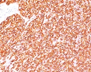 PTPRC Antibody