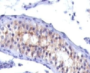 Prolactin Receptor Antibody [PRLR742]
