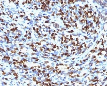 Myogenin Antibody [MGN185]