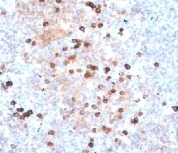 IgM Heavy Chain Antibody [IM373]