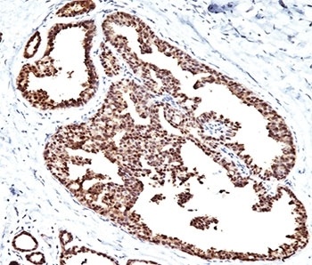 HSPD1 Antibody