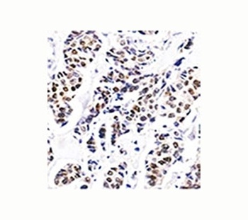 ESR1 Antibody