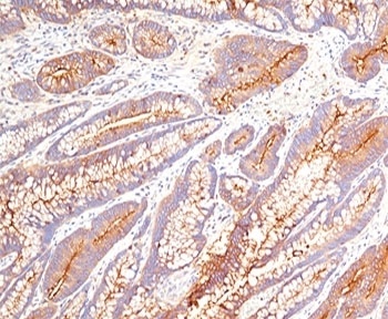 CEACAM5 Antibody