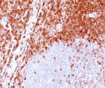 Bcl-2 Antibody [100/D5]