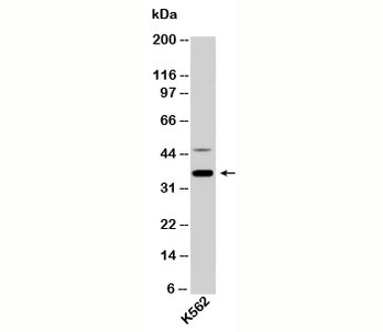 MKI67IP Antibody