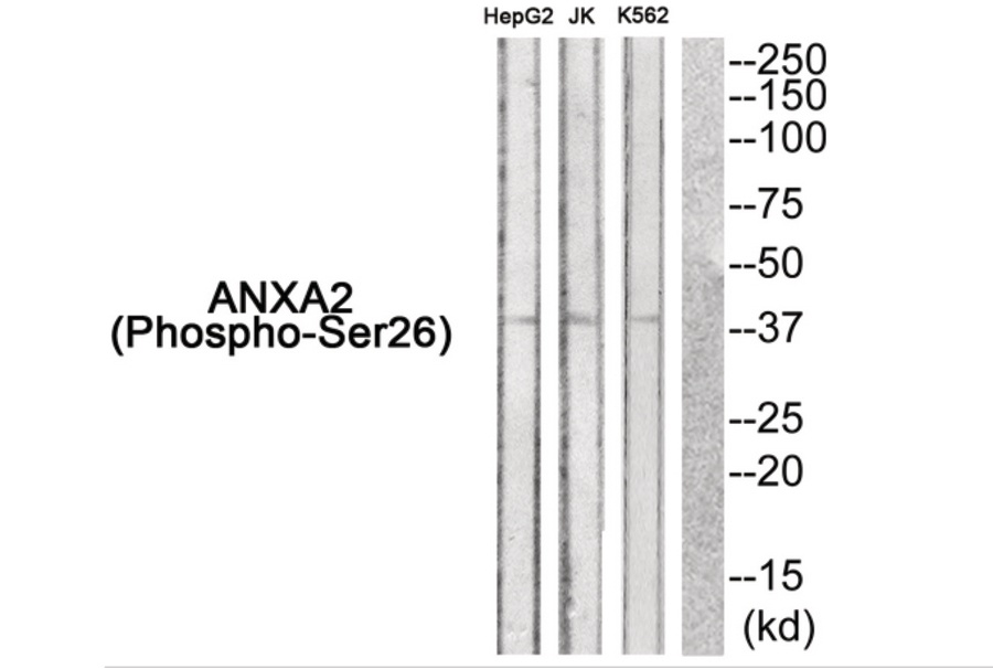 ANXA2 (phospho Ser26) Antibody