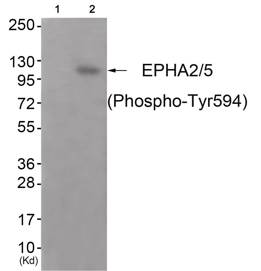 EPHA2, EPHA5 Antibody