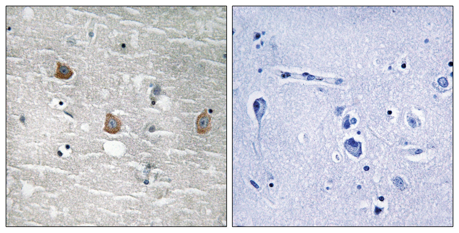 TOB1 Antibody