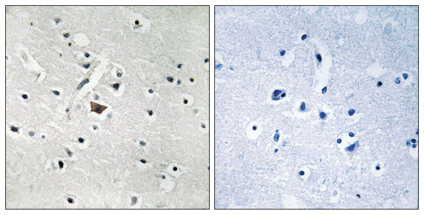 PLD2 (phospho Tyr169) Antibody
