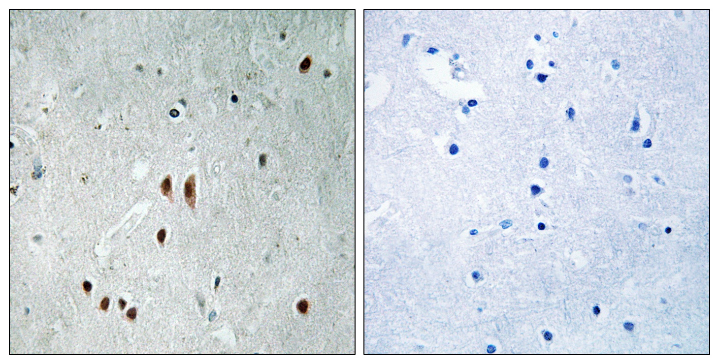 CNOT2 (phospho Ser101) Antibody