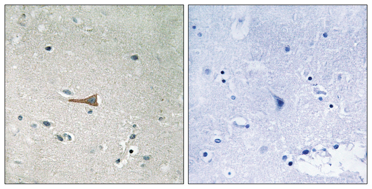 DDR1 (phospho Tyr513) Antibody