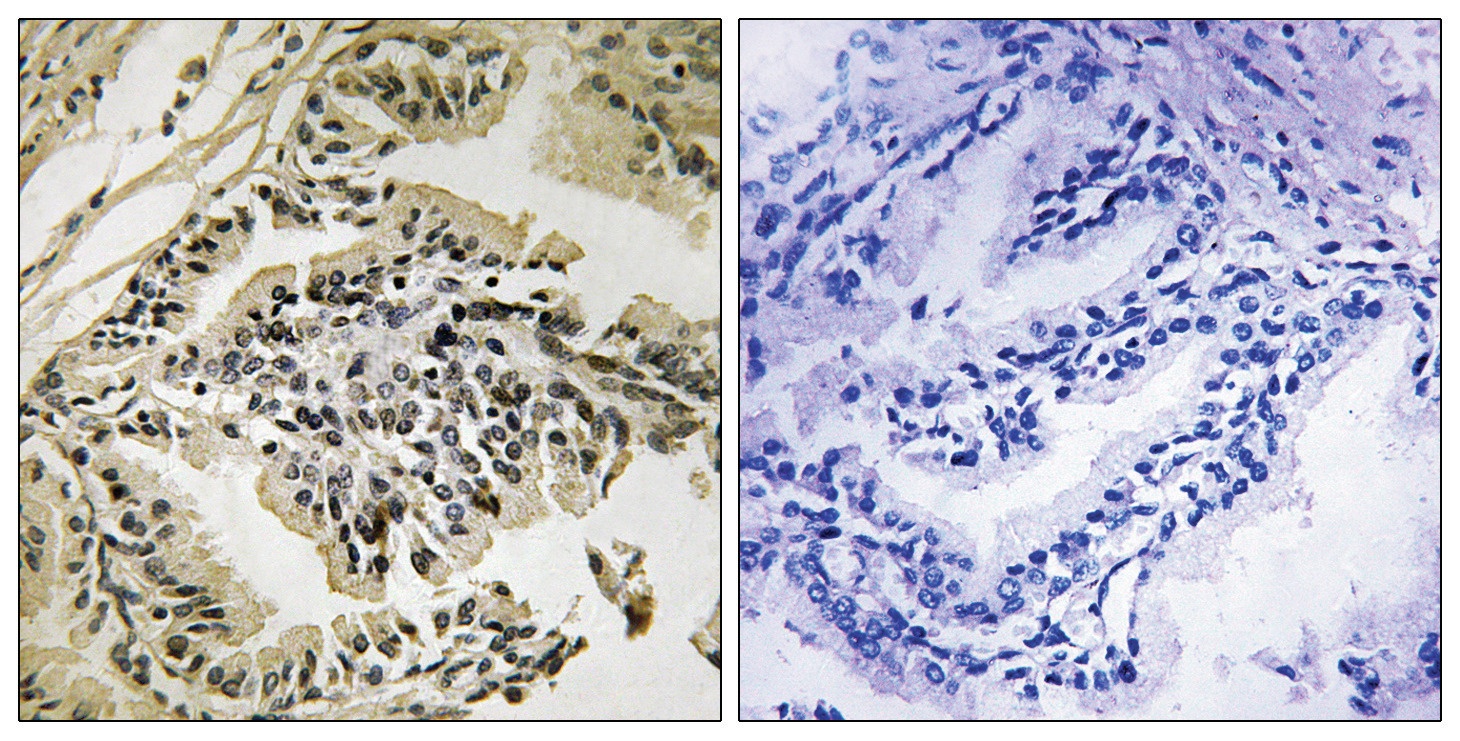 PEK/PERK (phospho Thr982) Antibody