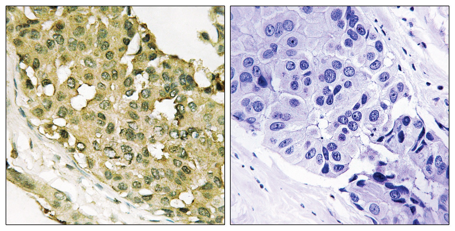 STMN1 (phospho Ser62) Antibody