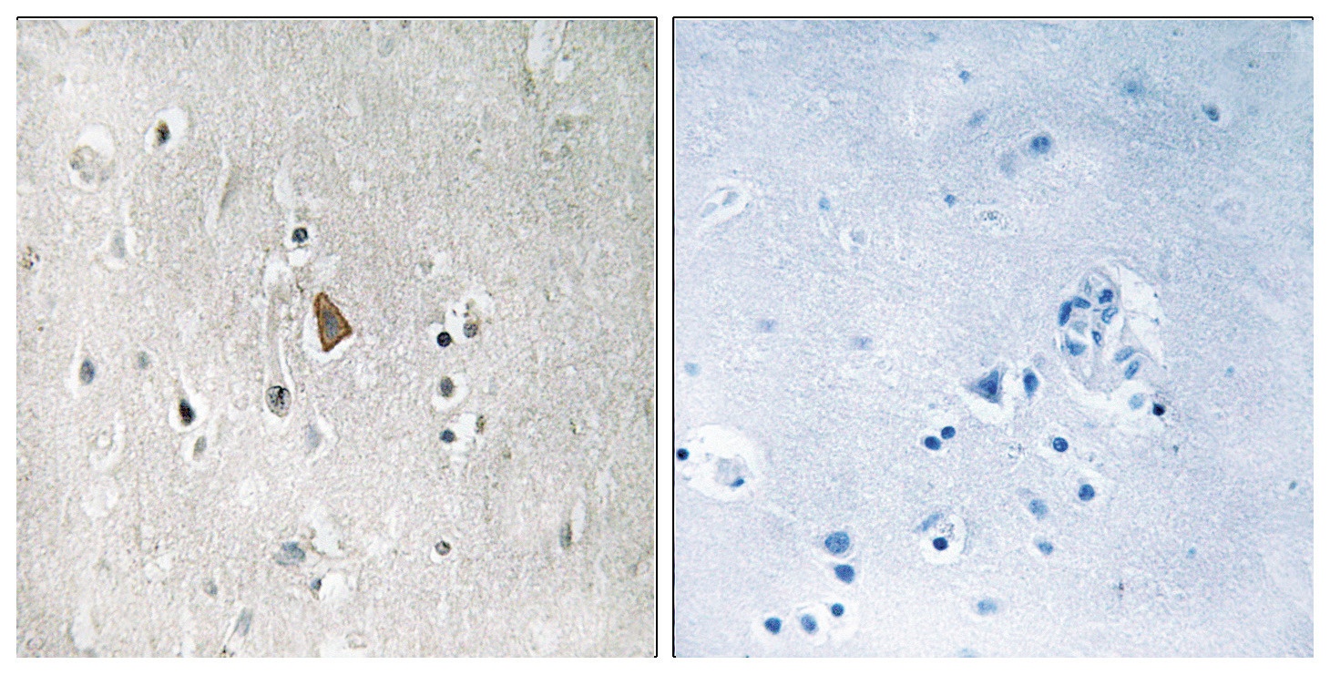 IGF1R (phospho Tyr1346) Antibody