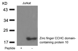 ZCCHC10 Antibody
