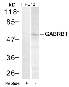 GABRB1 (Ab 434) Antibody