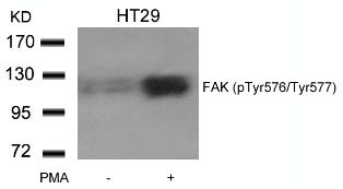 FAK (phospho Tyr576 / Tyr577) Antibody