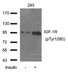 IGF1R Antibody