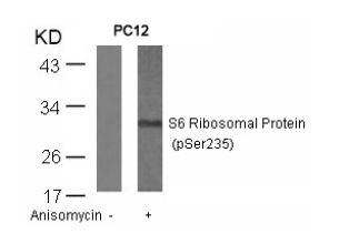 RPS6 Antibody