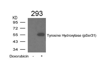 Tyrosine Hydroxylase (phospho Ser31) Antibody